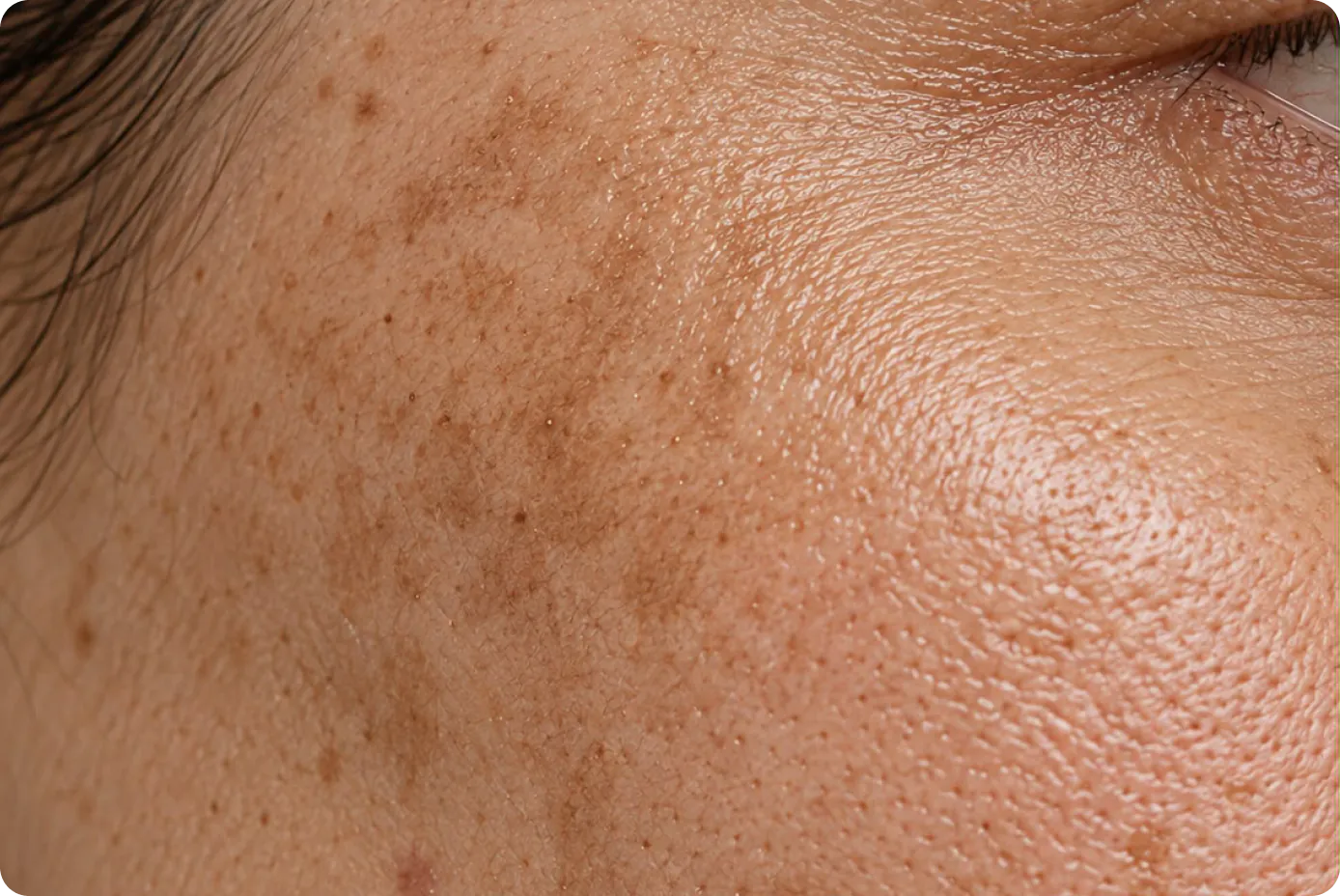 Paciente em avaliação dermatológica