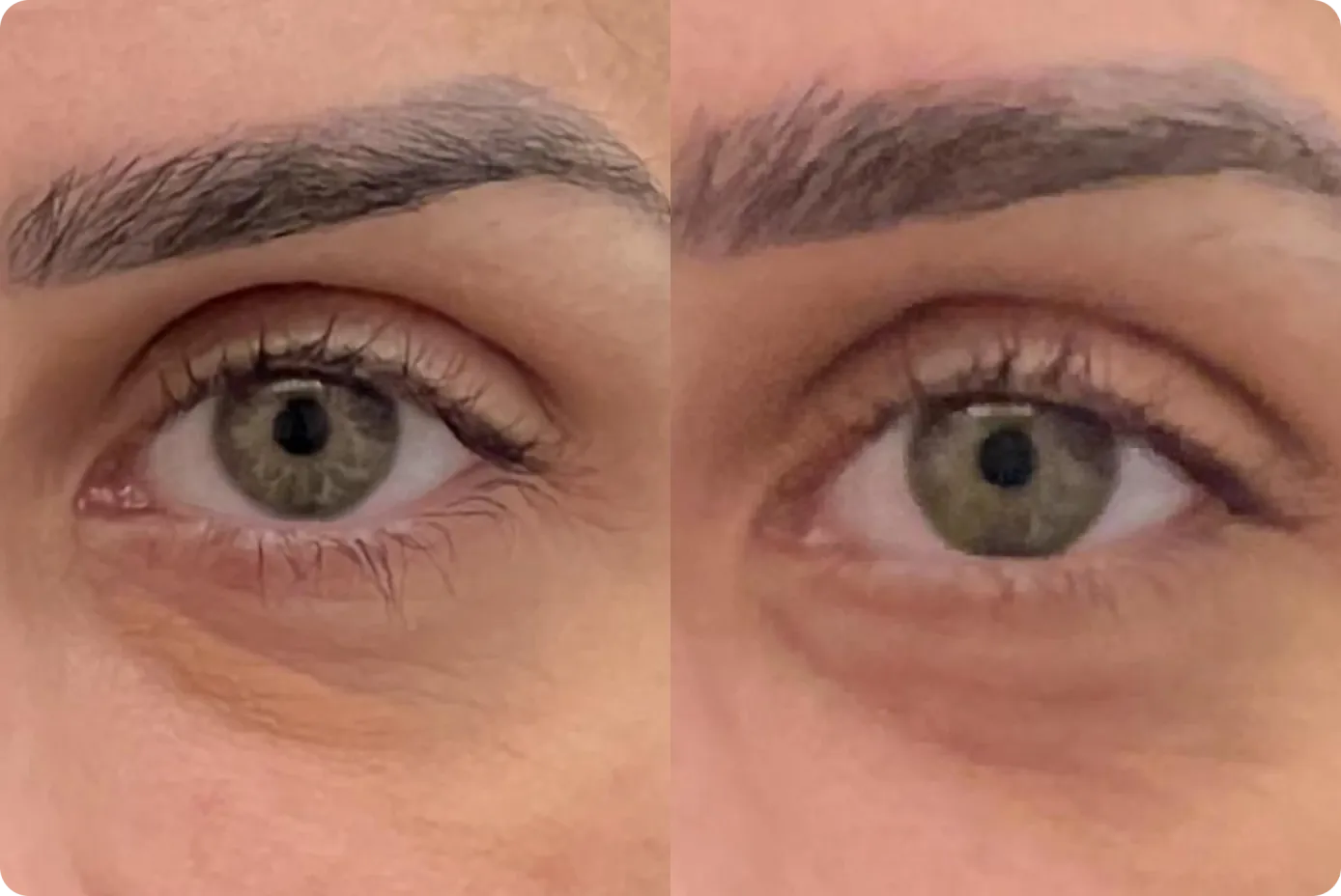 Avaliação das pálpebras e da região dos olhos